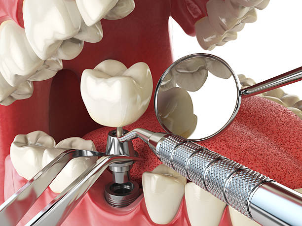 Best Urgent Tooth Repair  in Tyrone, OK