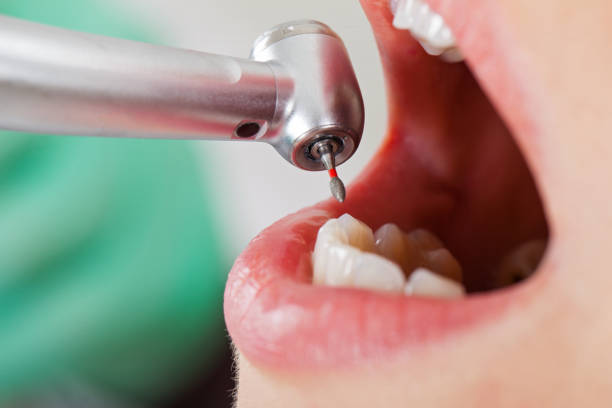 Best Broken Tooth Emergency  in Tyrone, OK